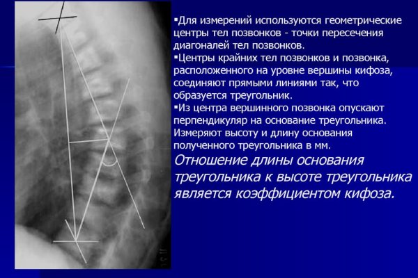 Kraken даркнет что это